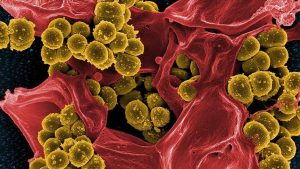 Antibiyotiklere dirençli bakteriler ‘koronavirüsten daha riskli