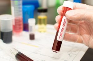 Koronavirüs aşısı bulundu mu, çalışmalar hangi aşamada?