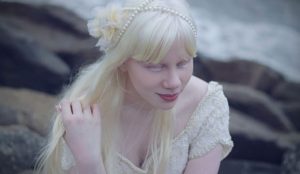 Albinizm: nedenleri, türleri ve belirtileri
