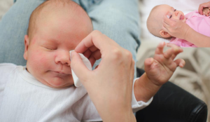 Bebeklerde çapak nasıl temizlenir? Bebeklerde göz çapaklanması neden olur ?
