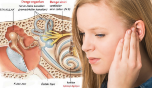 Kulak kristali kayması neden olur? Kulak kristalinin oynamasının belirtileri & Tedavisi