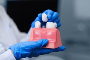 "Diş kaybı sıkıntılarında implant tedavisi en çok tercih edilen tahliller arasında"