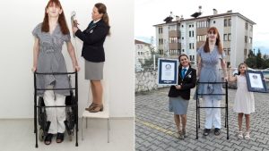 Rumeysa Gelgi, 'Dünyanın un uzun uzunluklu kadını' olarak Guinness Rekorlar Kitabı'na girdi