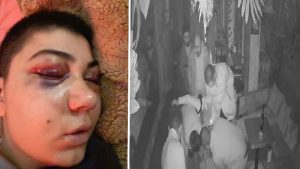 Taksim'de cümbüş yerinde tekme ve yumruklarla darp edilen bayanın yüzü felç oldu