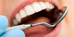 Türkiye’de yetişkinlerin yüzde 73'ünün dişleri çürük