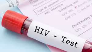 Yanlış HIV testine tazminat davası