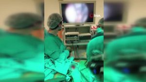 Bir hastaya tıpkı anda 4 kalp ameliyatı yapıldı