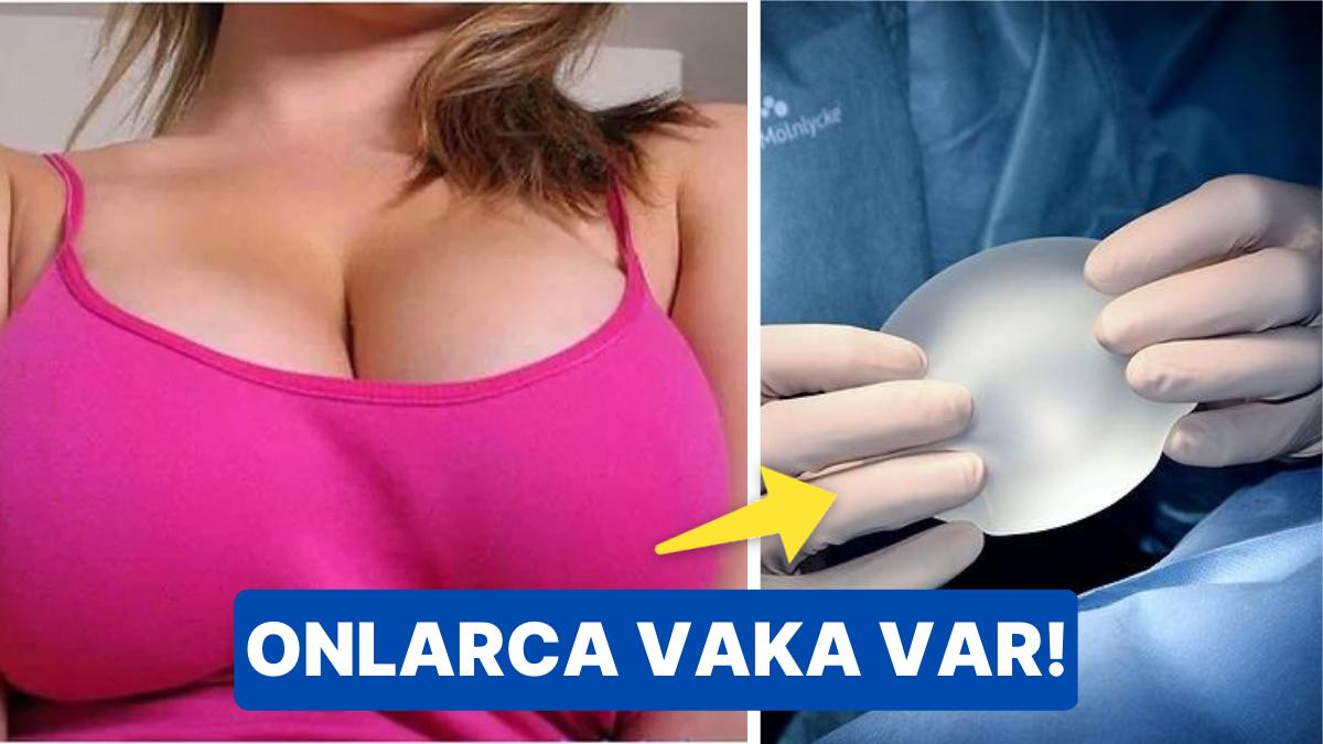 Uzmanlar Uyardı: Göğüs İmplantları Cilt Kanserine Sebep Oluyor!