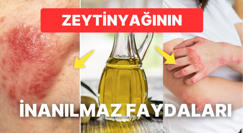 Aknelerin Yok Olmasından Gözeneklerin Sıkışlaşmasına Zeytinyağının Cilde Olan İnanılmaz Yararları