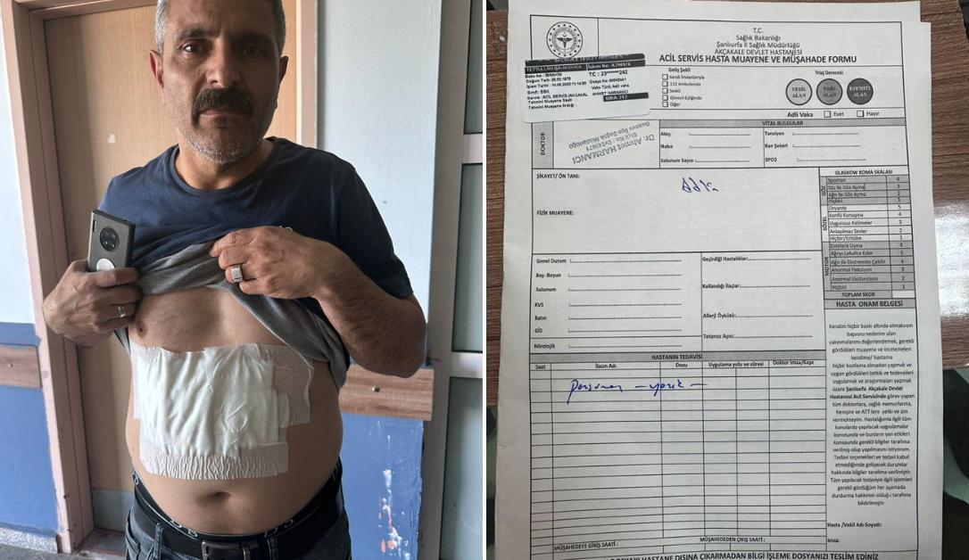 Blok Oy Kullanımına Karşı Çıkan Vazifelinin Üzerine Kaynar Su Döküldüğü Sav Edildi Blok Oy Kullanımına Karşı Çıkan Vazifelinin Üzerine Kaynar Su Döküldüğü Sav Edildi