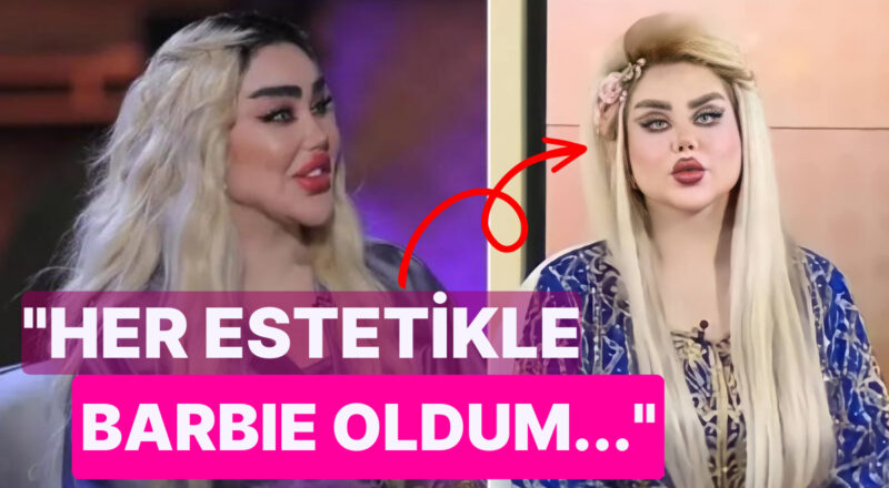 "Iraklı Barbie" Diyorlar! Barbie Bebeğe Benzemek İçin 43 Ameliyat Olan Bayanın Beyin Yakan Açıklamaları
