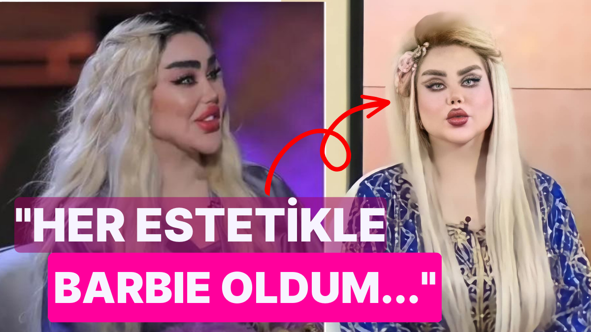 "Iraklı Barbie" Diyorlar! Barbie Bebeğe Benzemek İçin 43 Ameliyat Olan Bayanın Beyin Yakan Açıklamaları "Iraklı Barbie" Diyorlar! Barbie Bebeğe Benzemek İçin 43 Ameliyat Olan Bayanın Beyin Yakan Açıklamaları
