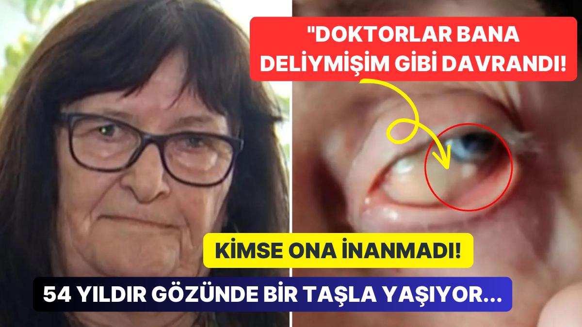 54 Yıl Boyunca Gözünde Bir Taşla Yaşayan Bayandan Kan Donduran Açıklamalar: "Doktorlar Beni Mecnun Sandı!"