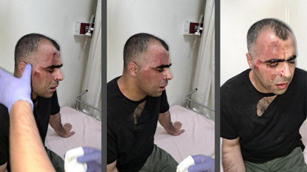 Gazeteciyi Öldüresiye Dövmüşlerdi: Polis ve Müdafaa Gözaltına Alındı Gazeteciyi Öldüresiye Dövmüşlerdi: Polis ve Müdafaa Gözaltına Alındı