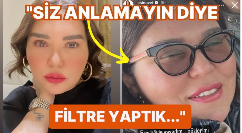 Göz Kapağı Estetiği Yüzünden Gözünden Oluyordu: Gazeteci Esin Övet de Estetik Kurbanı Oldu!