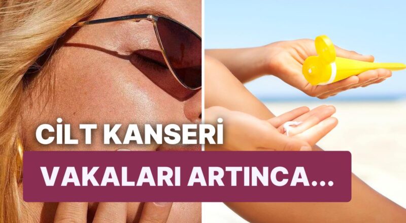 Hollanda, Artan Cilt Kanseriyle Çaba Etmek İçin Halka Fiyatsız Güneş Kremi Dağıtacak!