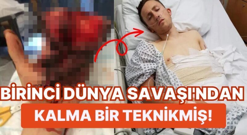 Müthiş Bir Kaza Geçiren İtfaiyecinin Hayatını Kurtarmak İçin Elini Midesine Diktiler!