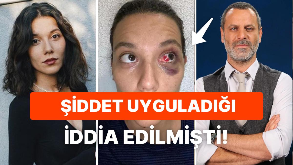 Ozan İtimat ve Deniz Bulutsuz Davasında Yeni Gelişme: ''Bütün Fotoğraflar Photoshop, Montaj'' Ozan İtimat ve Deniz Bulutsuz Davasında Yeni Gelişme: ''Bütün Fotoğraflar Photoshop, Montaj''
