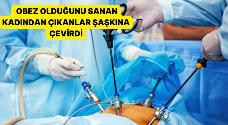 Tıp Dünyası Hayret İçinde: Obez Olduğunu Sanan Bayandan Çıkanlar Şaşkına Çevirdi