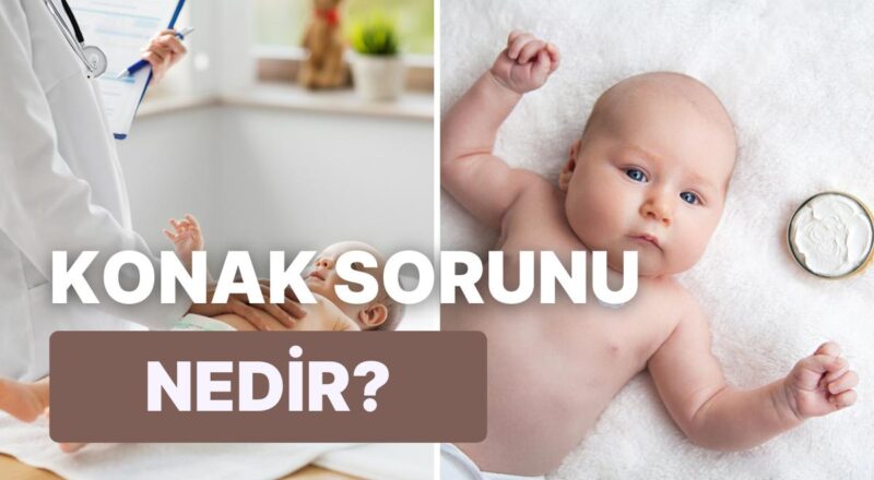 Bebeklerde Çok Sık Görülen Cilt Meselelerinden Olan Konak Neden Olur?