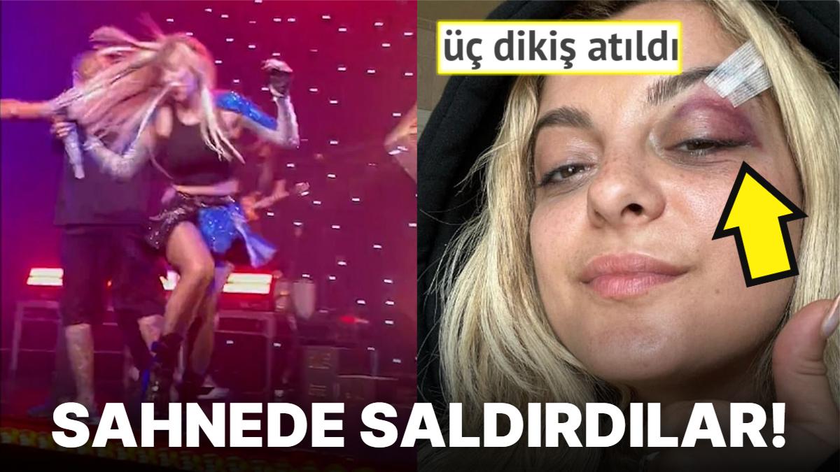 Hayranları Tarafından Taarruza Uğrayarak Şöhret Sahibi Olmanın Sillesini Ağır Bir Biçimde Yemiş Ünlü İsimler Hayranları Tarafından Taarruza Uğrayarak Şöhret Sahibi Olmanın Sillesini Ağır Bir Biçimde Yemiş Ünlü İsimler