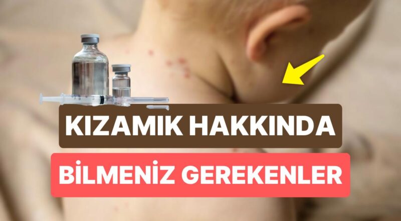 Kızamık Aşısı Ne Vakit Yapılır? Kızamık Nedir, Belirtileri Neler?