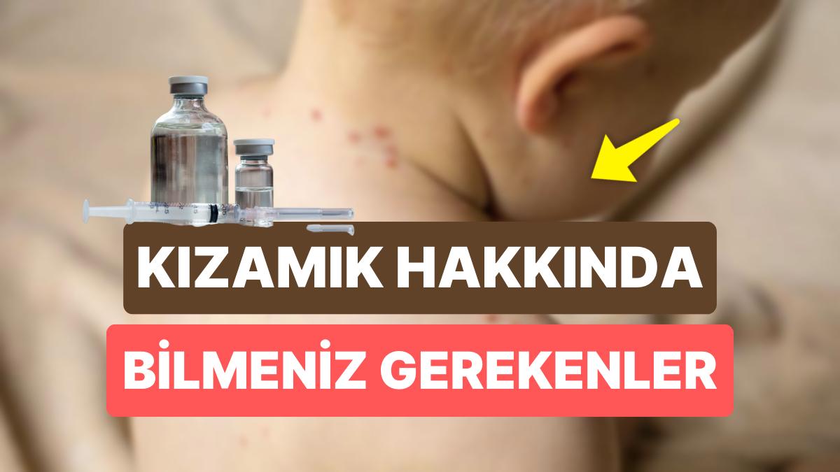 Kızamık Aşısı Ne Vakit Yapılır? Kızamık Nedir, Belirtileri Neler?