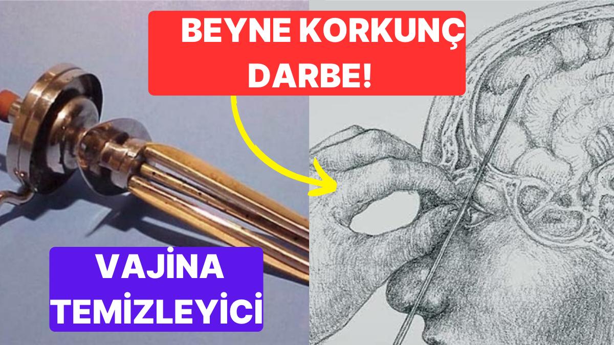 Günümüzde İnsanlık Dışı Olarak Kabul Edilse de Geçmişte Uygulanan Dehşetli Tedavi Teknikleri Günümüzde İnsanlık Dışı Olarak Kabul Edilse de Geçmişte Uygulanan Dehşetli Tedavi Teknikleri