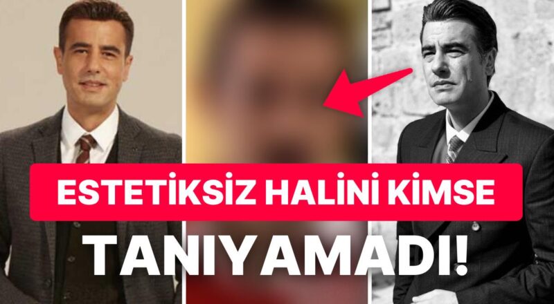Ömer Dizisinin Erdal'ı Tayanç Ayaydın'ın Estetik Yaptırmadan Evvelki Hali Ortaya Çıktı: Görenler Şok Oldu!