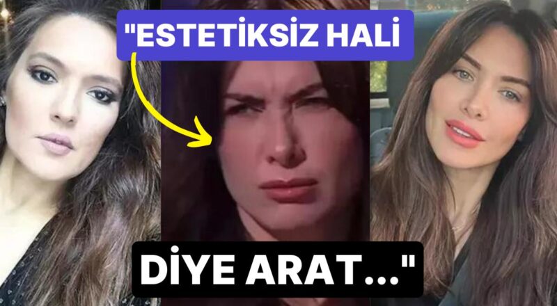 Botoks Yaptırmadığını Söyleyen Oyuncu Nefise Karatay'a Demet Akalın'dan Çok Tartışılan Yorum Geldi