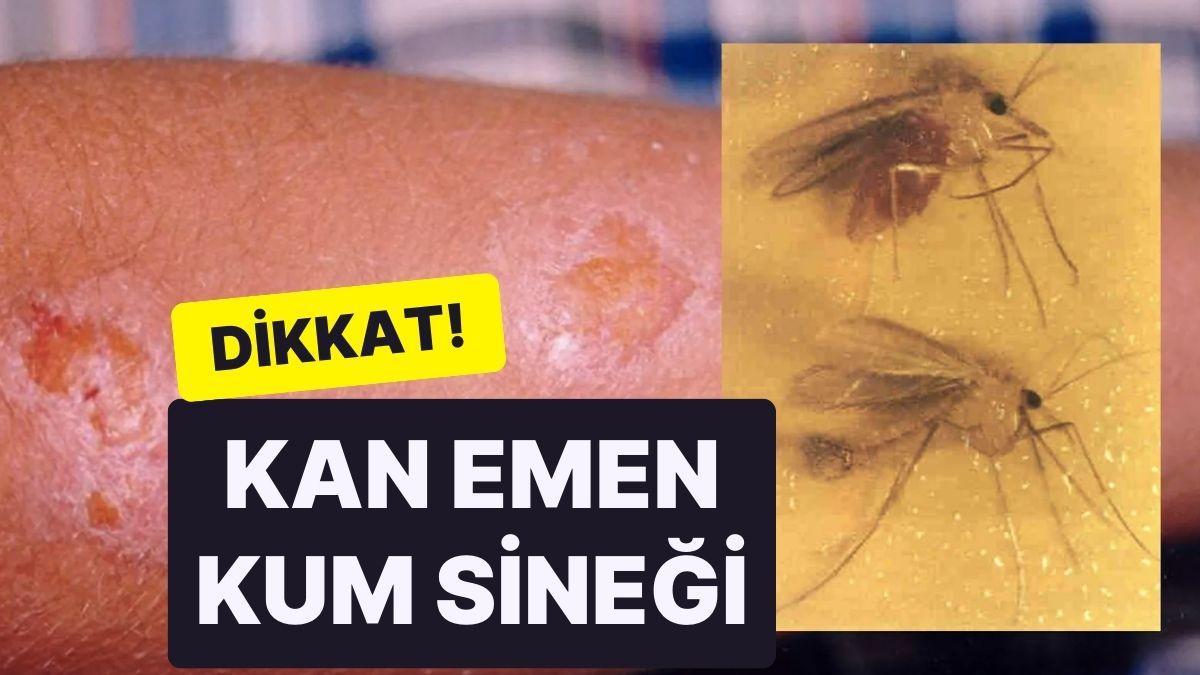 Dikkat! Kan Emen Kum Sineği Tehlikesi: "Sivrisinekle Gayret Etmekten Daha Zor”