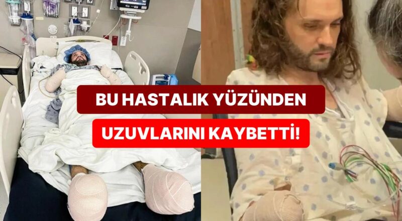 Grip Semptomlarıyla Hastaneye Gidip Ölümcül Bir Hastalığa Sahip Olduğu Anlaşılan Adam Tıp Dünyasını Şoke Etti