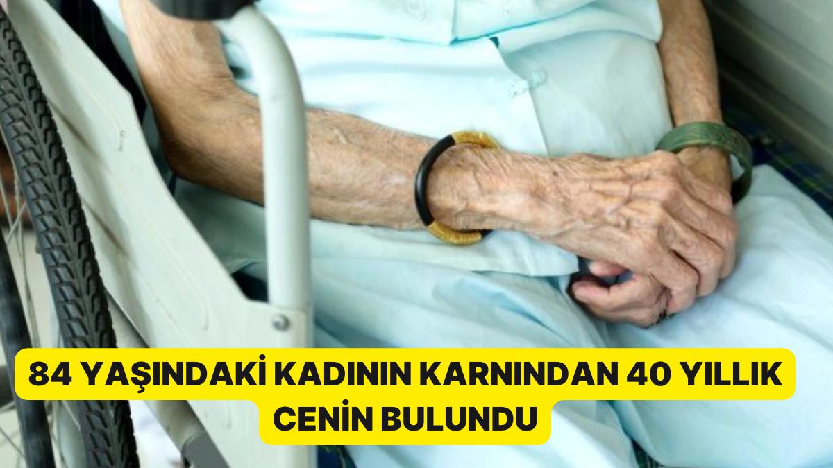 84 Yaşındaki Bayanın Karnında 40 Yıllık Cenin Bulundu 84 Yaşındaki Bayanın Karnında 40 Yıllık Cenin Bulundu